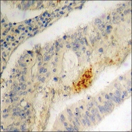Merck Anti-phospho-IRF-3 (pSer396) antibody produced in rabbit