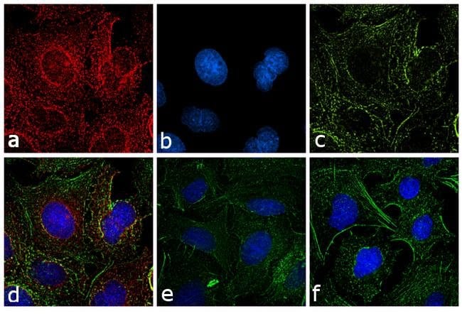 Thermo Fisher Scientific Chicken anti-Rat IgG (H+L) Cross-Adsorbed Secondary Antibody, Alexa Fluor 647