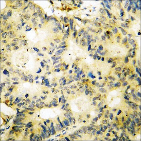 Merck Anti-phospho-SYK (pTyr348) antibody produced in rabbit