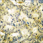 Merck Anti-phospho-SYK (pTyr348) antibody produced in rabbit