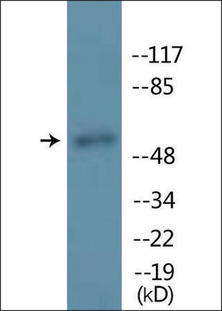 Merck Anti-phospho-MITF (pSer180/73) antibody produced in rabbit