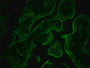 Merck MONOCLONAL ANTI-CYTOKERATIN PEPTIDE 8, &