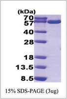 Merck TXNRD1, HUMAN