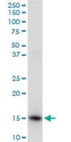 Merck ANTI-ISG15