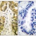 Merck ANTI-GALECTIN 3