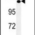 Merck ANTI-POTEE (CENTER)