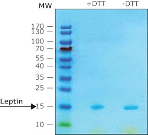 Merck LEPTIN HUMAN,>=97% (SDS-PAGE), RECOMBINA