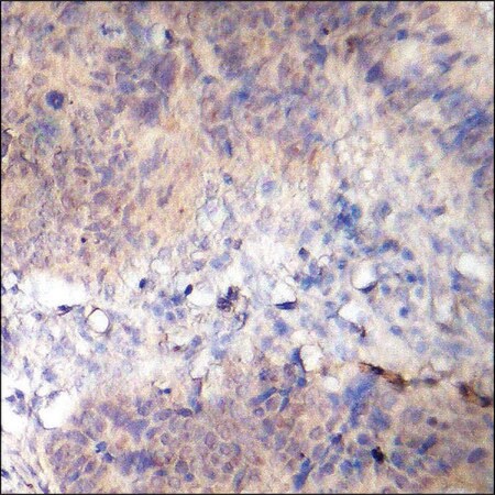 Merck Anti-phospho-AS160 (pThr642) antibody produced in rabbit