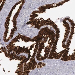 Merck Anti-PTGS2 antibody produced in rabbitp&