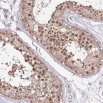 Merck Anti-ITPKC antibody produced in rabbit
