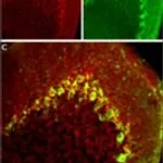 Merck ANTI-CALCIUM CHANEL CAV3.2 (ALPHA1H)