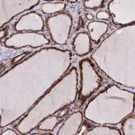 Merck Anti-FKBP10 antibody produced in rabbit