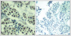 Merck ANTI-MDM2 (AB-166)