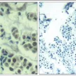 Merck ANTI-MDM2 (AB-166)