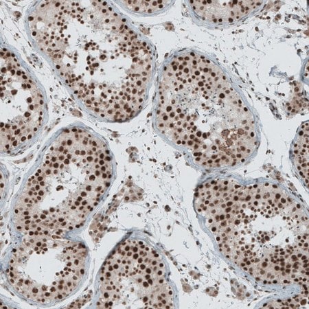 Merck Anti-SENP1 antibody produced in rabbit