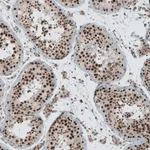 Merck Anti-SENP1 antibody produced in rabbit