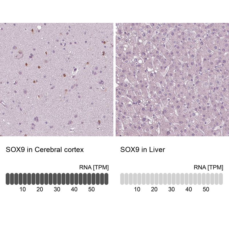Atlas Antibodies Anti-SOX9 Antibody
