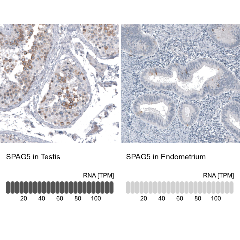 Atlas Antibodies Anti-SPAG5 Antibody