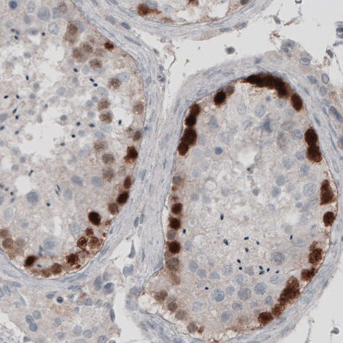 Atlas Antibodies Anti-SSX2 Antibody
