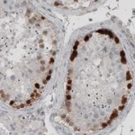 Atlas Antibodies Anti-SSX2 Antibody