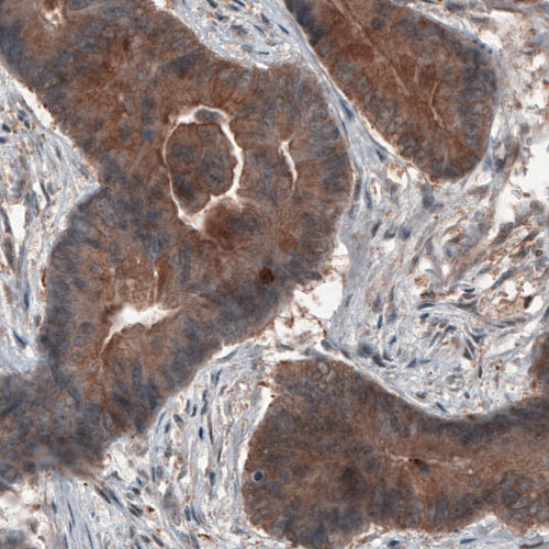 Atlas Antibodies Anti-ST13 Antibody