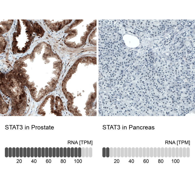 Atlas Antibodies Anti-STAT3 Antibody