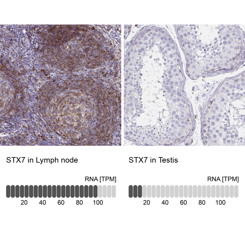 Atlas Antibodies Anti-STX7 Antibody