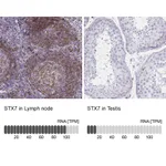 Atlas Antibodies Anti-STX7 Antibody