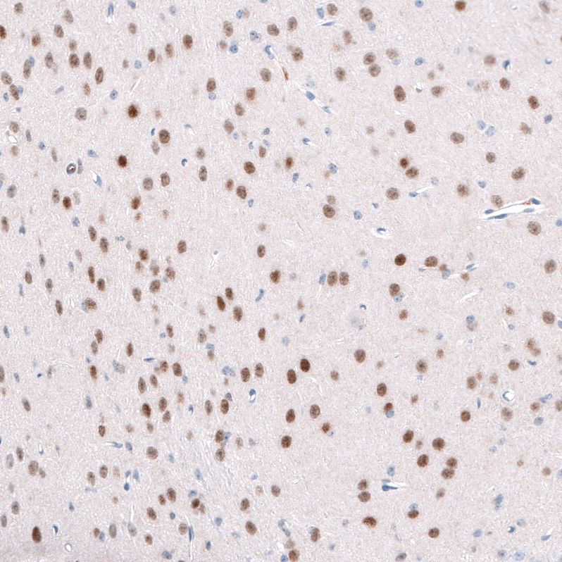 Atlas Antibodies Anti-TCF7L2 Antibody