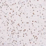 Atlas Antibodies Anti-TCF7L2 Antibody