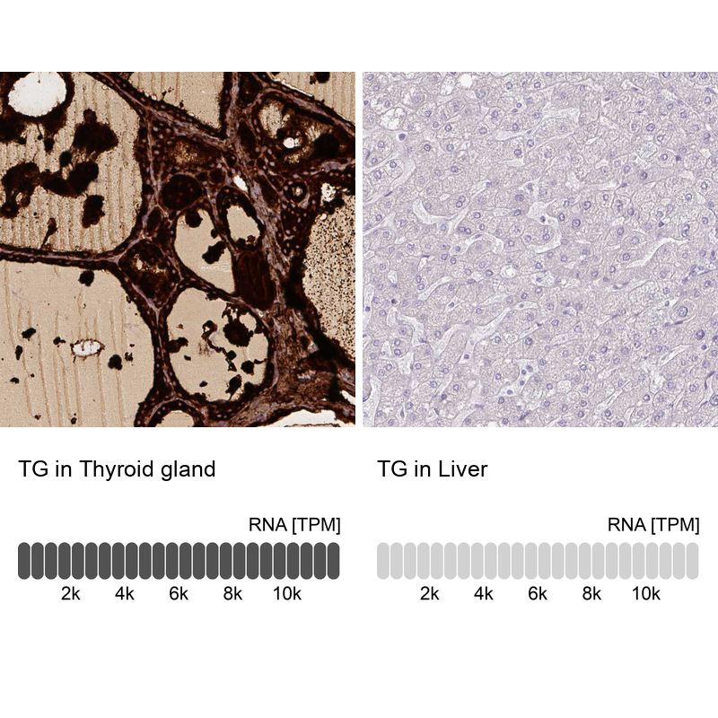 Atlas Antibodies Anti-TG Antibody