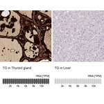 Atlas Antibodies Anti-TG Antibody