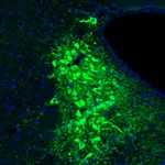 Atlas Antibodies Anti-TH Antibody