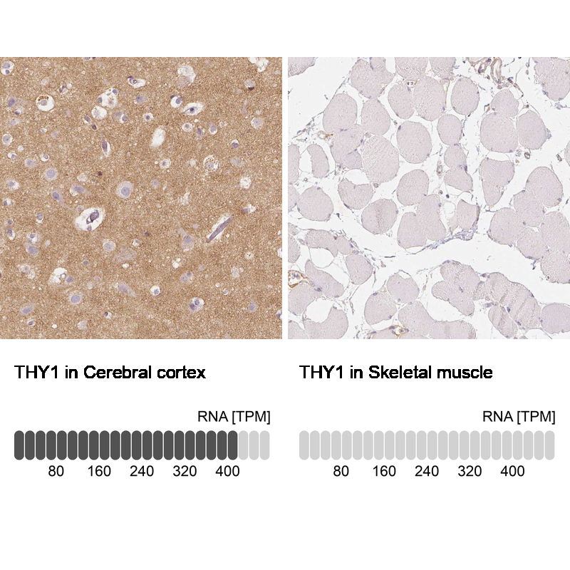 Atlas Antibodies Anti-THY1 Antibody