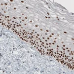 Atlas Antibodies Anti-TLE3 Antibody