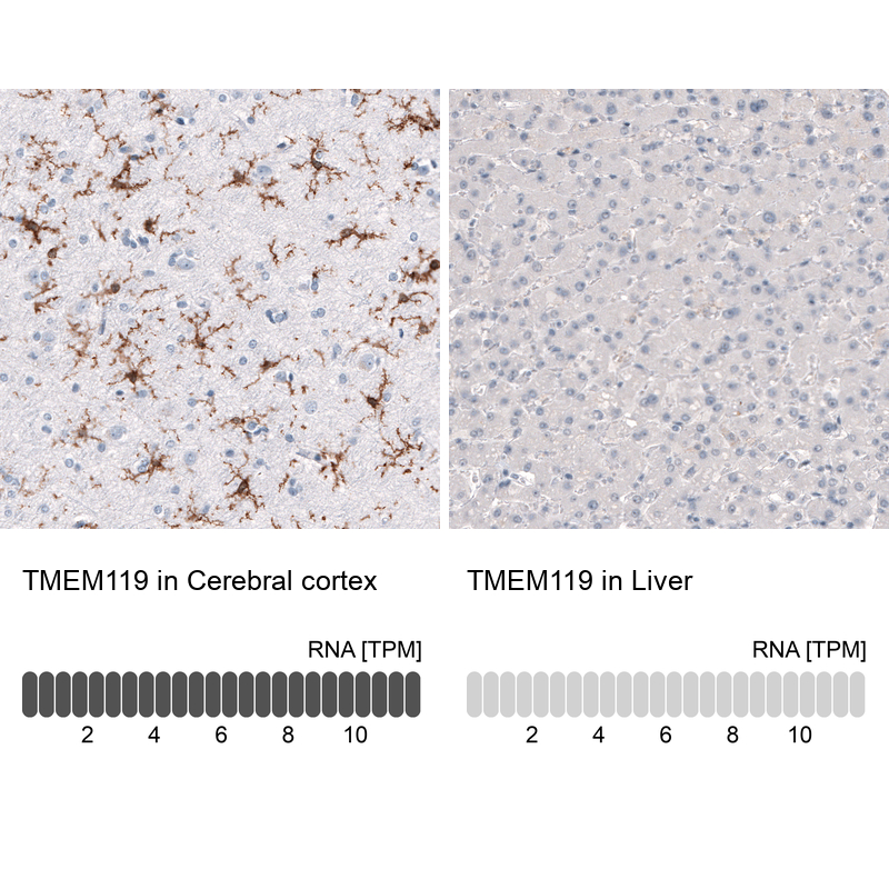 Atlas Antibodies Anti-TMEM119 Antibody