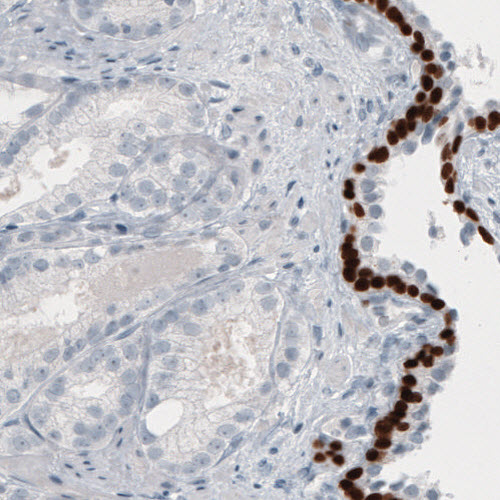 Atlas Antibodies Anti-TP63 Antibody