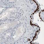 Atlas Antibodies Anti-TP63 Antibody