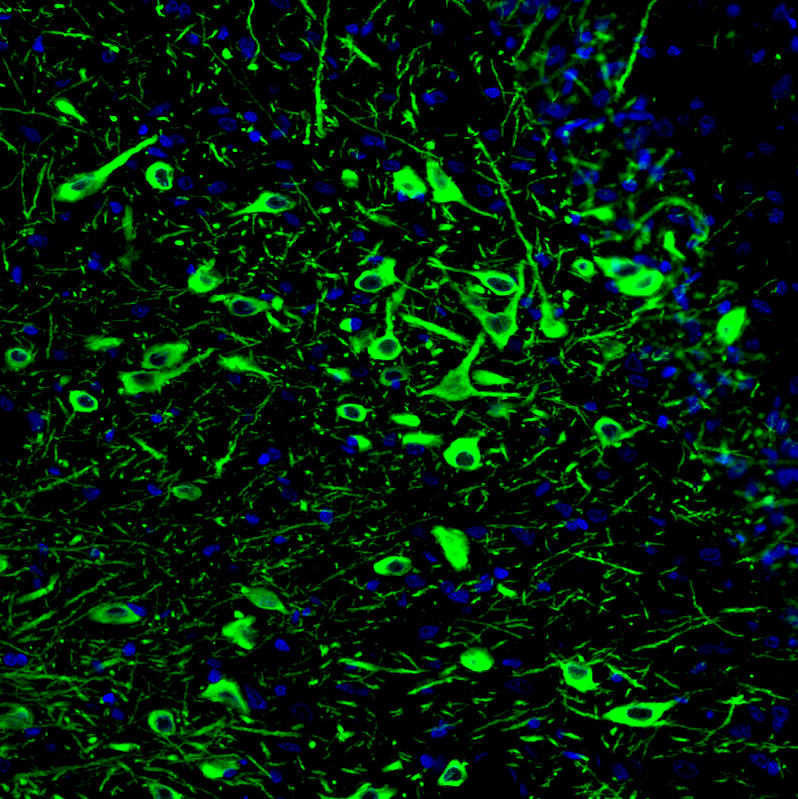Atlas Antibodies Anti-TPH2 Antibody