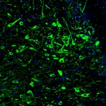 Atlas Antibodies Anti-TPH2 Antibody