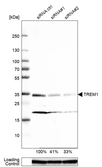 Atlas Antibodies Anti-TREM1 Antibody
