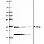 Atlas Antibodies Anti-TREM1 Antibody