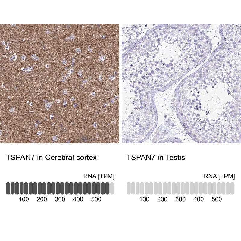 Atlas Antibodies Anti-TSPAN7 Antibody