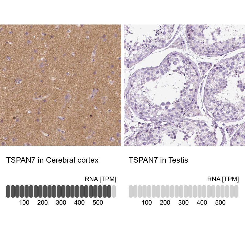 Atlas Antibodies Anti-TSPAN7 Antibody