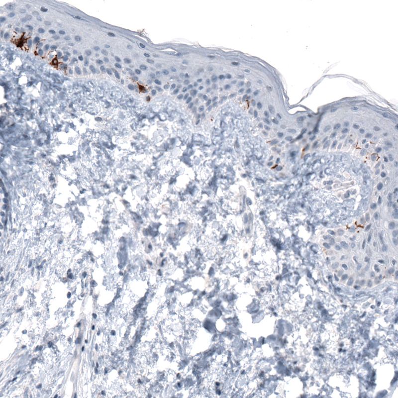Atlas Antibodies Anti-TYRP1 Antibody