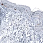 Atlas Antibodies Anti-TYRP1 Antibody