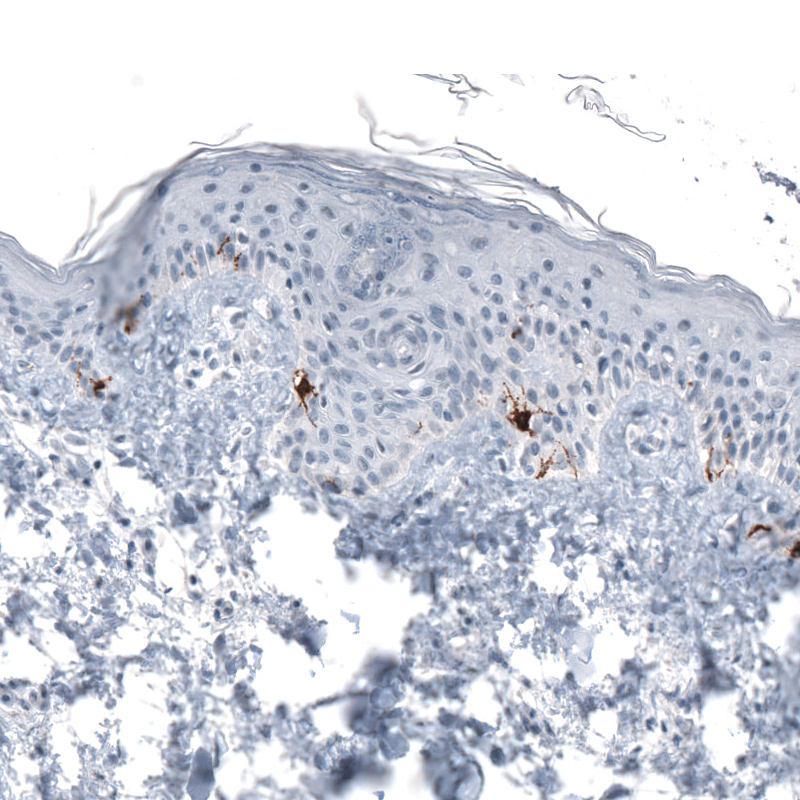 Atlas Antibodies Anti-TYRP1 Antibody