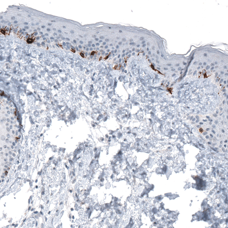 Atlas Antibodies Anti-TYRP1 Antibody