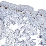 Atlas Antibodies Anti-TYRP1 Antibody
