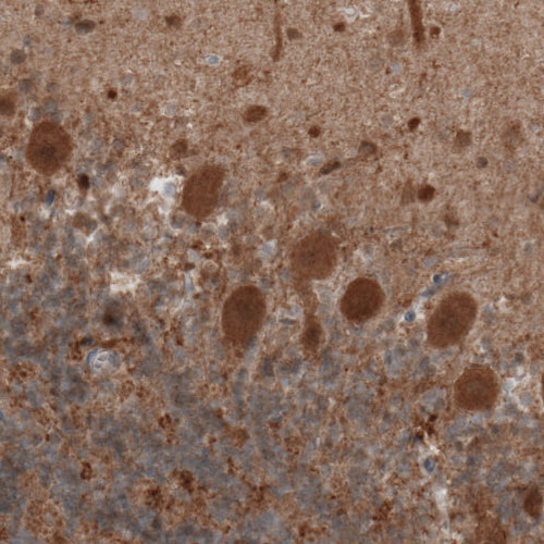 Atlas Antibodies Anti-UCHL1 Antibody